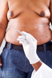 weight loss surgery Savannah